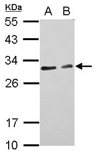 IHC-plus™ Polyclonal Rabbit anti-Human FSP27 / CIDEC Antibody (IHC, IF, WB)