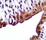 UPK3A / UPK3 / Uroplakin III Antibody
