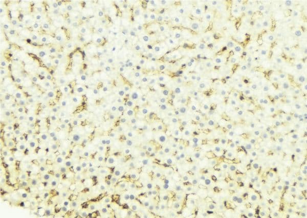 Polyclonal Rabbit anti-Human CYP4B1 Antibody (IHC, IF, WB)