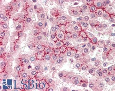 IHC-plus™ Polyclonal Rabbit anti-Human ABCC2 / MRP2 Antibody (aa825-875, IHC)