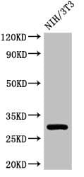 HLA-DQB1 Antibody