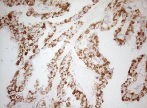 DECR1 Antibody (clone OTI7B11)