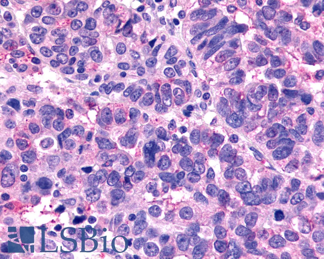 IHC-plus™ Polyclonal Rabbit anti-Human MRGX1 / MRGPRX1 Antibody (N-Terminus, IHC)