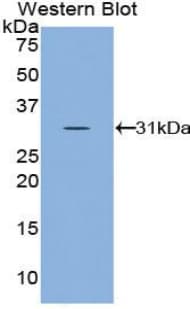 CCS Antibody (aa17-270)