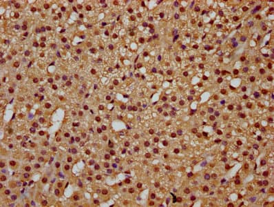 Polyclonal Rabbit anti-Human TCERG1 / CA150 Antibody (IHC, WB)