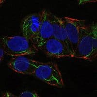 PRKAA1 / AMPK Alpha 1 Antibody (clone 2B7)