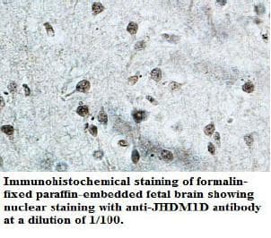 Polyclonal Rabbit anti-Human KDM7A / JHDM1D Antibody (aa586-601, IHC, WB)