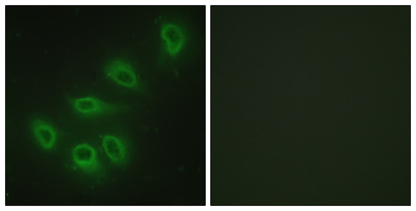 Polyclonal Rabbit anti-Human NOS3 / eNOS Antibody (aa1145-1194, IF, WB)