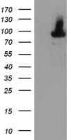 ALOX15 / 15-Lipoxygenase Antibody (clone OTI8C5)