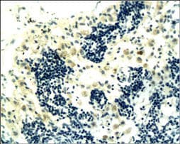 Polyclonal Rabbit anti-Human CD4 Antibody (IHC, WB)