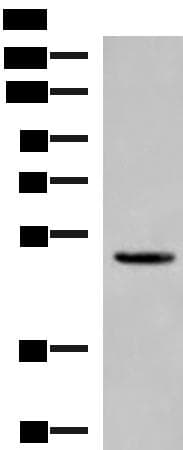 PSMD12 / Rpn5 Antibody