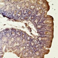 ACTA2 / Smooth Muscle Actin Antibody