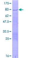 Human TRIM17 / RNF16 Protein (Recombinant GST)