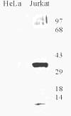 OGG1 Antibody (aa1-100, DY488)