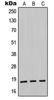 MDK / Midkine Antibody (Internal)