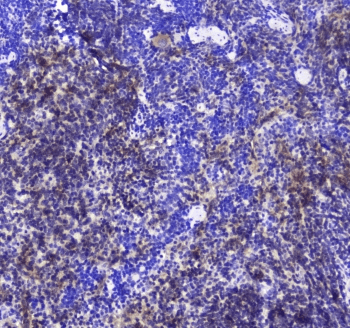 INPP5D / SHIP1 / SHIP Antibody