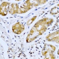 Polyclonal Rabbit anti-Human SMYD4 Antibody (IHC, IF, WB)