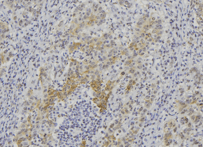Polyclonal Rabbit anti-Human EDN1 / Endothelin 1 Antibody (IHC, WB)
