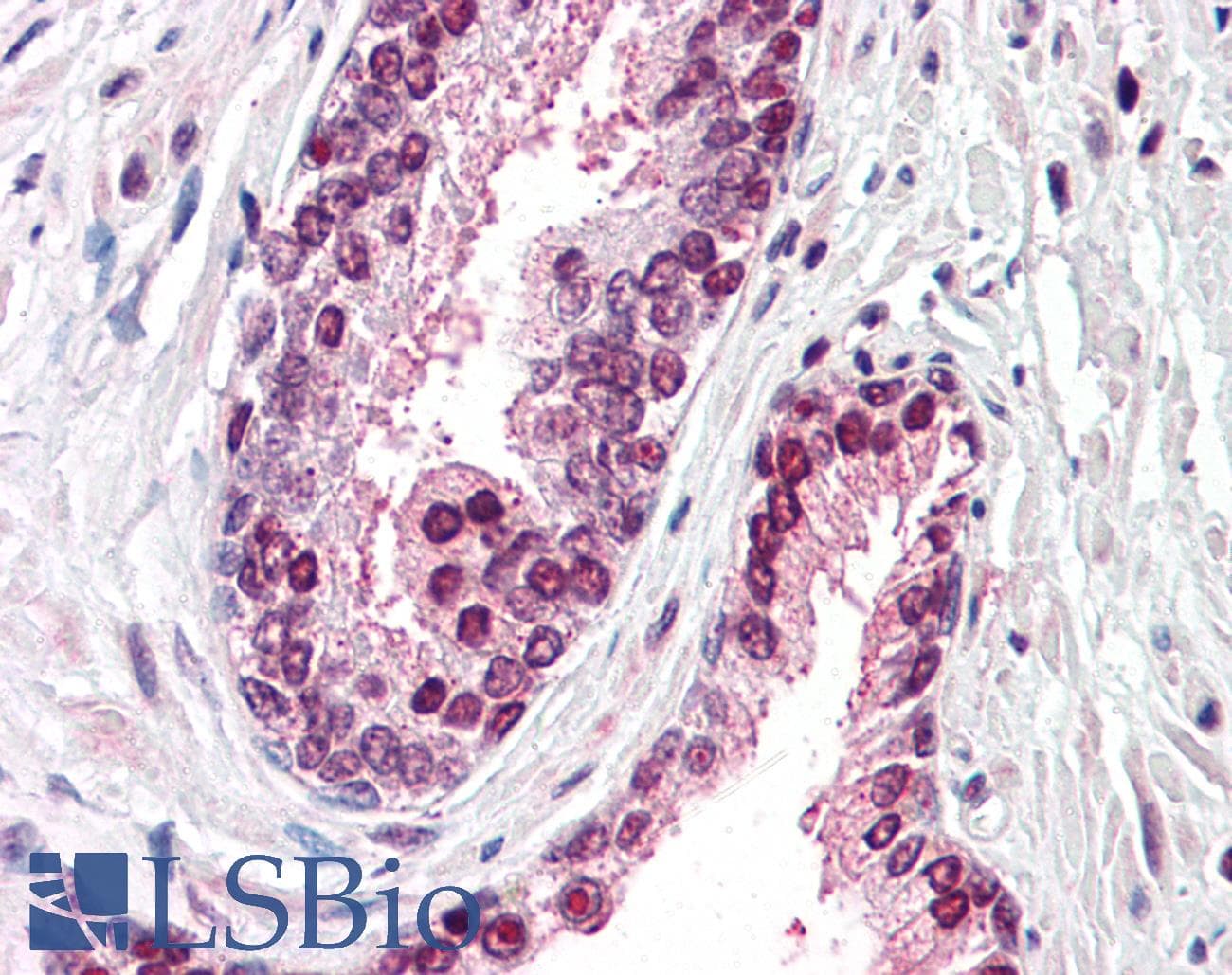 IHC-plus™ CDCP1 Antibody (Internal)