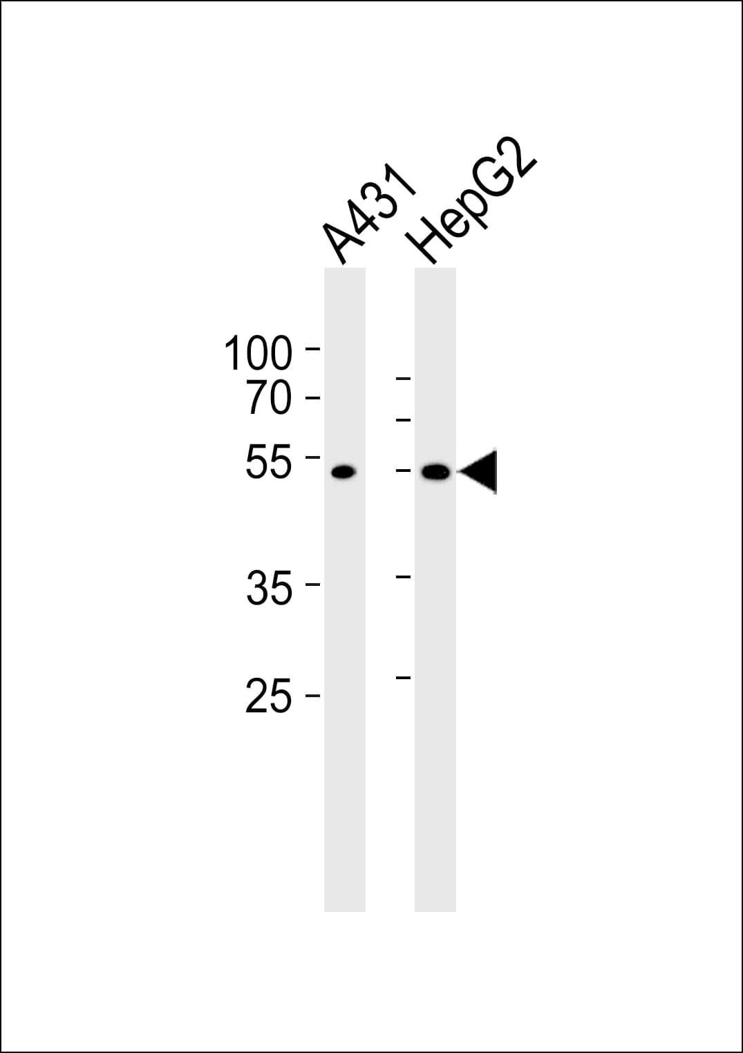 Polyclonal Rabbit anti-Human SAMM50 Antibody (aa346-380, WB)