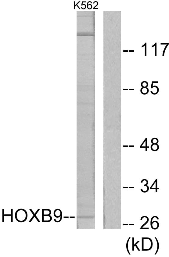 Polyclonal Rabbit anti-Human HOXB9 Antibody (aa201-250, WB)
