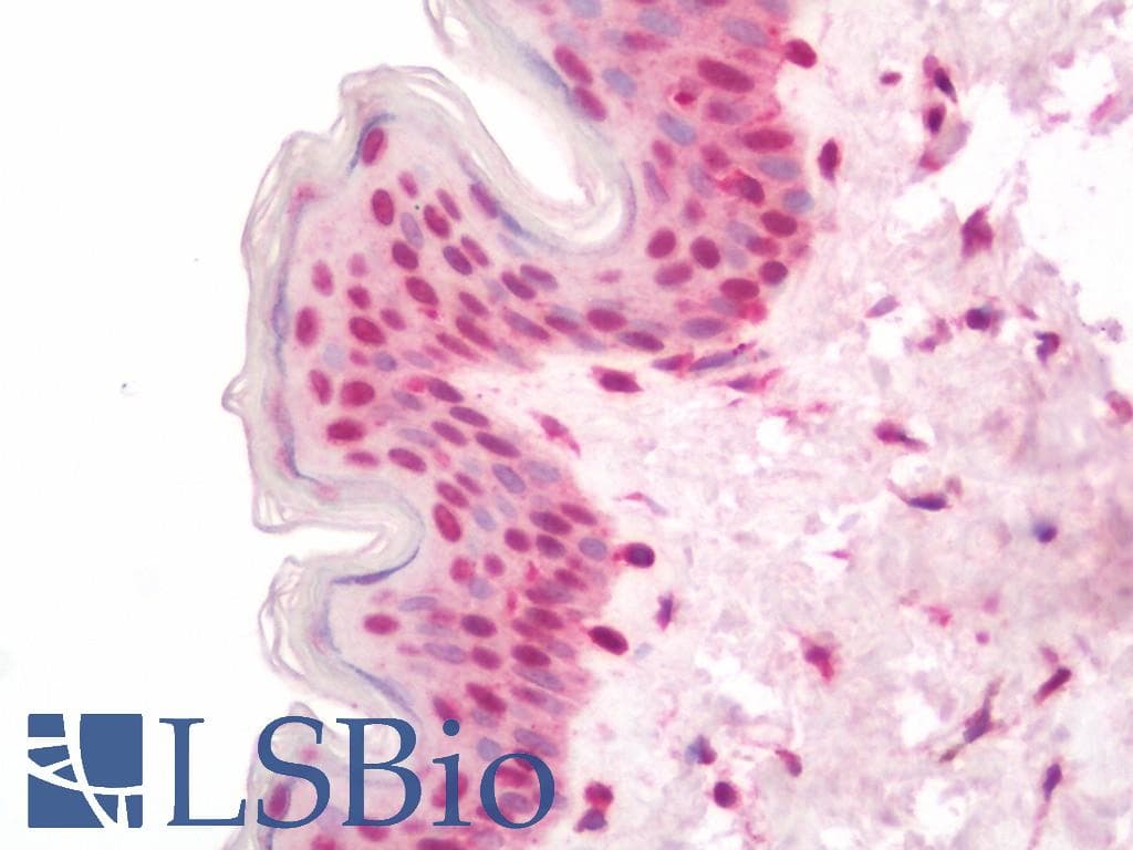 IHC-plus™ Polyclonal Rabbit anti-Human PRX-1 / PRRX1 Antibody (IHC, WB)