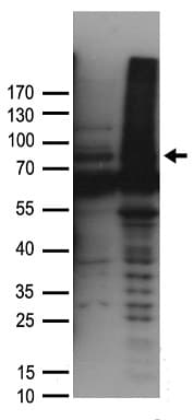Polyclonal Rabbit anti-Human GLCNE / GNE Antibody (WB)
