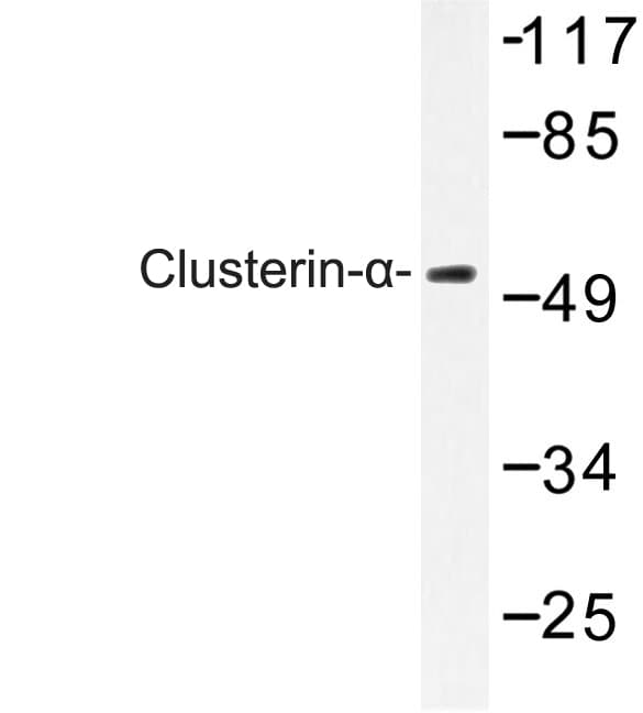 IHC-plus™ Polyclonal Rabbit anti-Human CLU / Clusterin Antibody (Glu436, IHC, IF, WB)