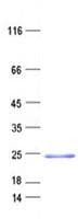 Human C17orf49 Protein (Recombinant His, N-Terminal)