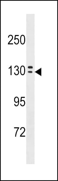 OVCH1 Antibody (aa89-118)