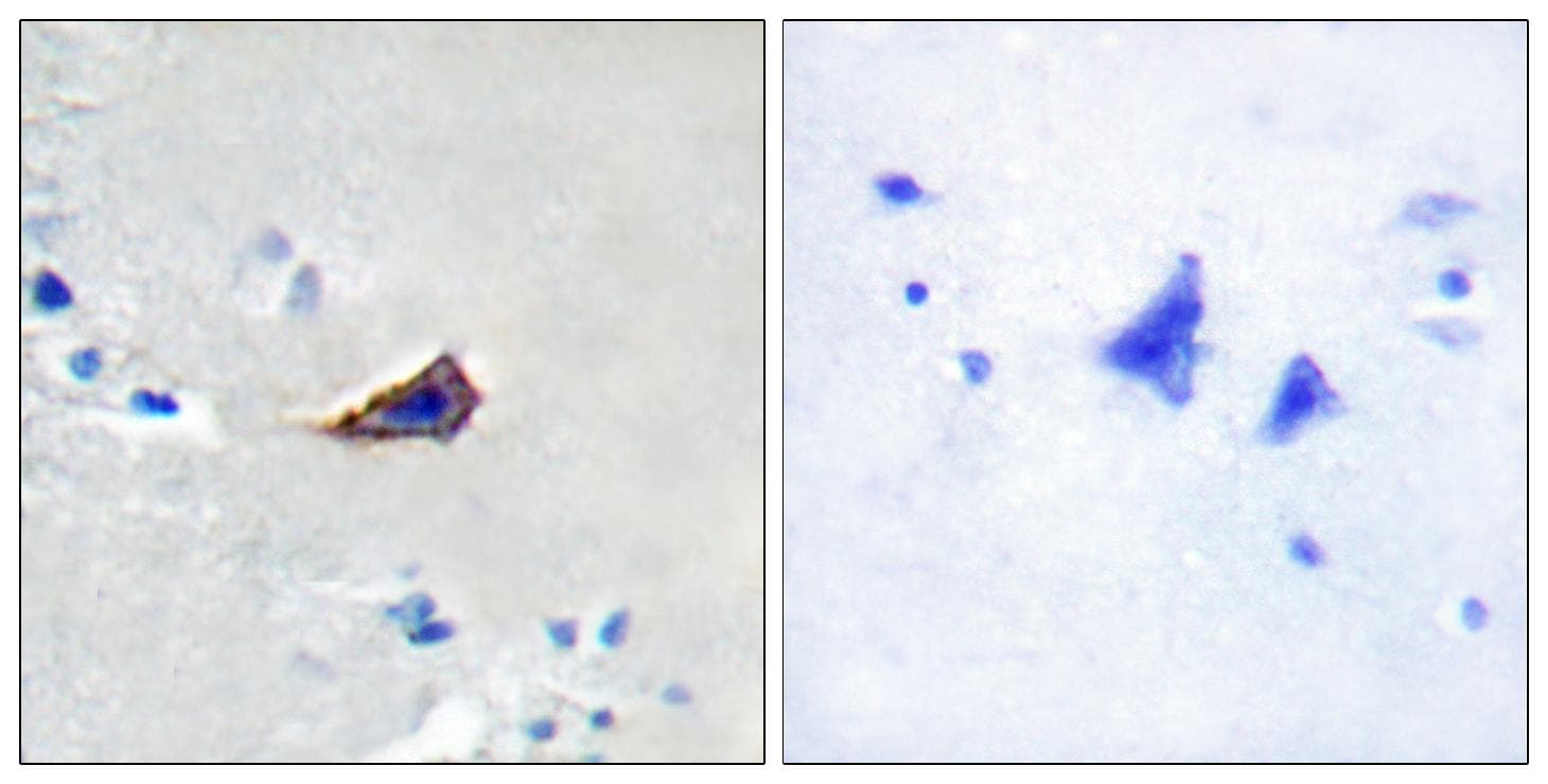 AQP2 / Aquaporin 2 Antibody (Ab-256)