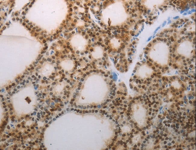 S100A1 / S100-A1 Antibody