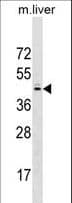 SPRY2 / Sprouty 2 Antibody (aa6-35)