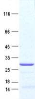 Human TNNI3 / Cardiac Troponin I Protein (Recombinant DDK,C-terminus)