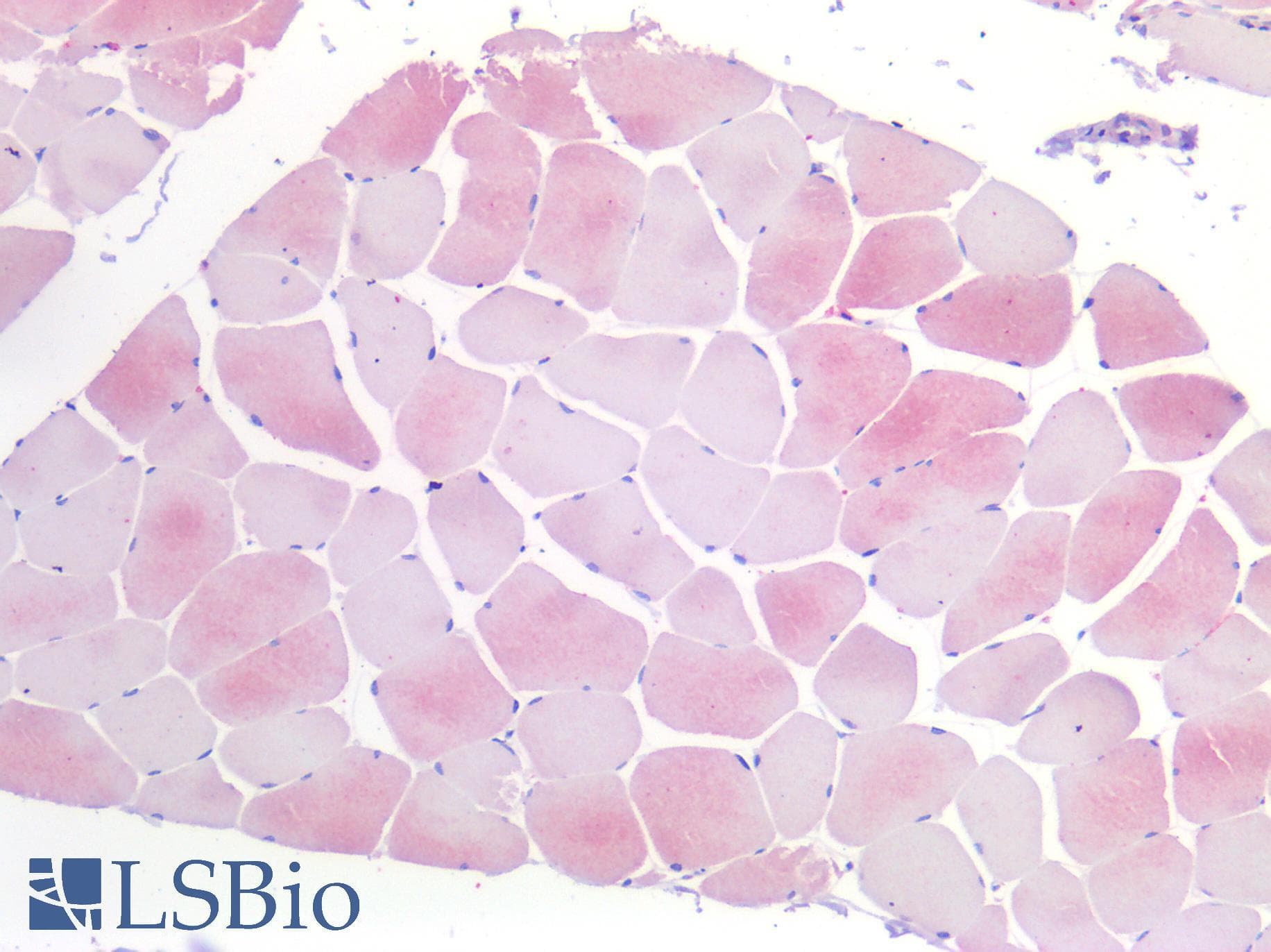 IHC-plus™ IL6R / IL6 Receptor Antibody