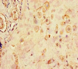 LHB / Luteinizing Hormone Antibody