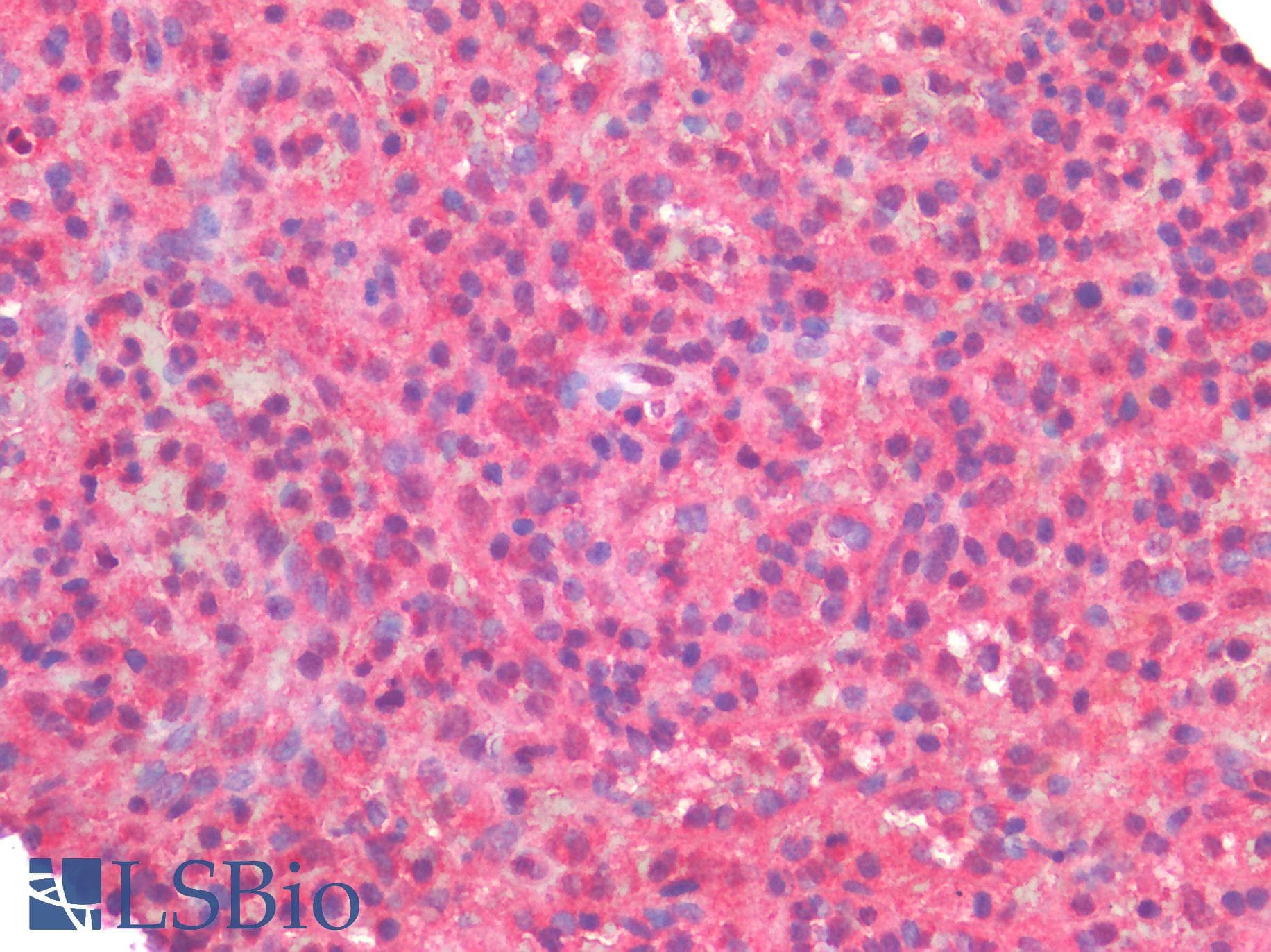 IHC-plus™ Polyclonal Rabbit anti-Human CSF1R / CD115 / FMS Antibody (IHC)