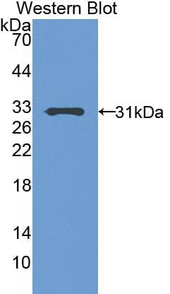 PAPPA / PAPP-A Antibody (aa244-501, Biotin)