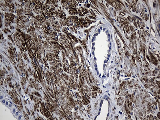 Monoclonal Mouse anti-Human MLC3F / MYL1 Antibody (clone OTI1H3, aa2-150, IHC, WB)