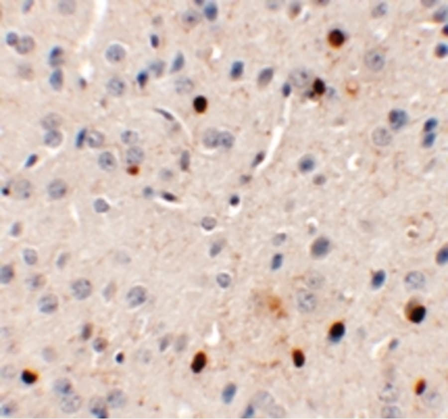 SPRYD3 Antibody