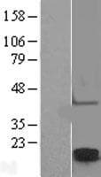 CLDN2 / Claudin 2 Protein (Over-Expression Lysate Myc-DDK (Flag))