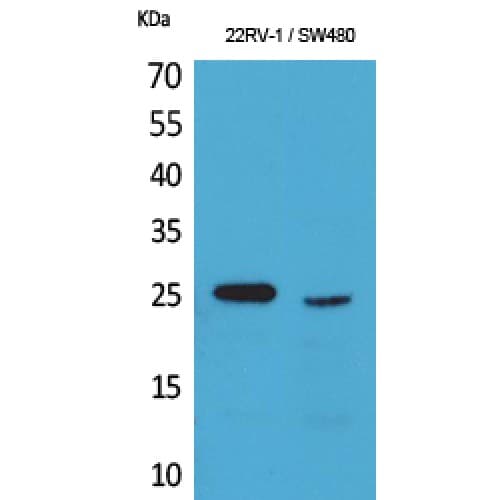 Polyclonal Rabbit anti-Human SSX1 Antibody (C-terminal, IHC, WB)