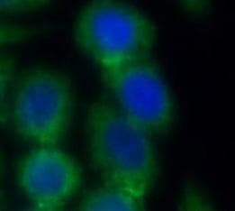 Monoclonal Mouse anti-Human PDI / P4HB Antibody (IHC, WB)