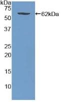 Mouse WNT5A Protein (Recombinant GST, N-terminus)