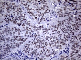 NBN / Nibrin Antibody (clone OTI8E6)