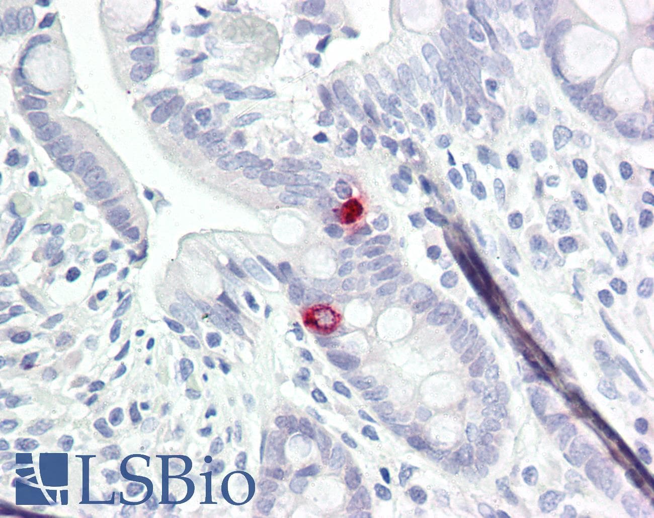 NTM / Neurotrimin Antibody (aa91-140)