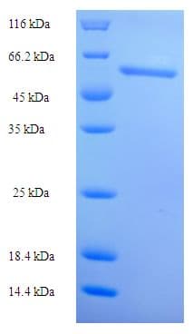 Human FLAD1 / FADS Protein (Recombinant His-SUMO)