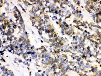 Polyclonal Rabbit anti-Human ATXN3 / JOS Antibody (IHC, WB)
