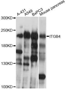 Polyclonal Rabbit anti-Human ITGB4 / Integrin Beta 4 Antibody (WB)