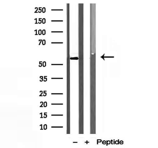 PDLIM7 / Enigma Antibody